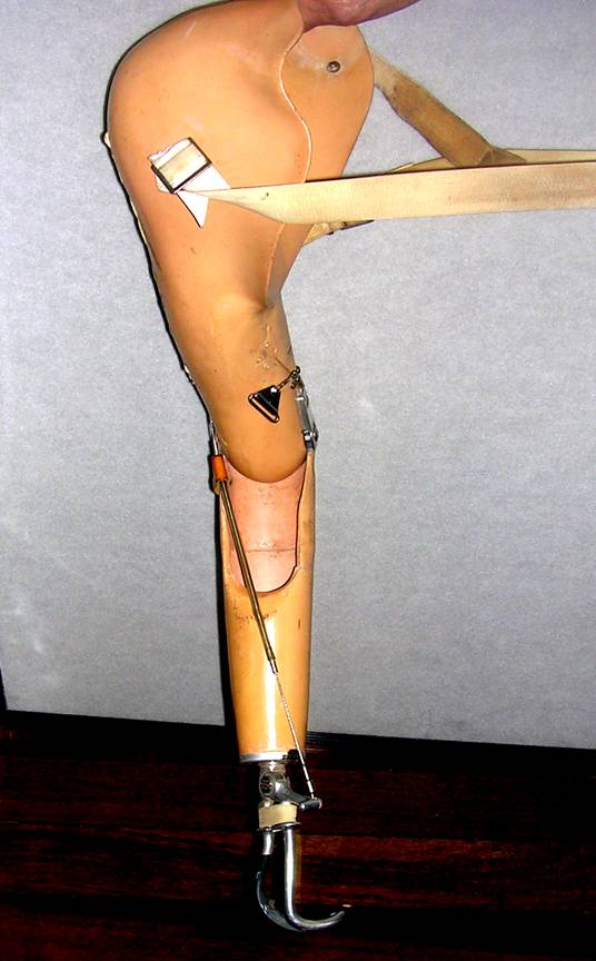 Limb prostheses